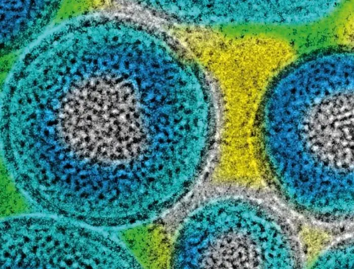 borna virus — DE news