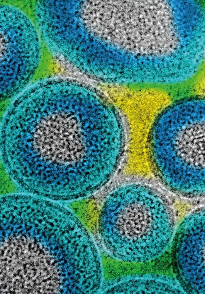 borna virus — DE news