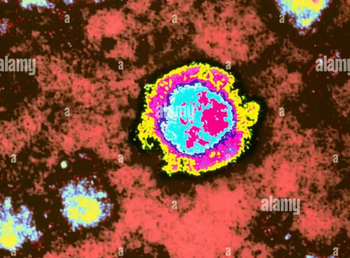 borna virus — DE news