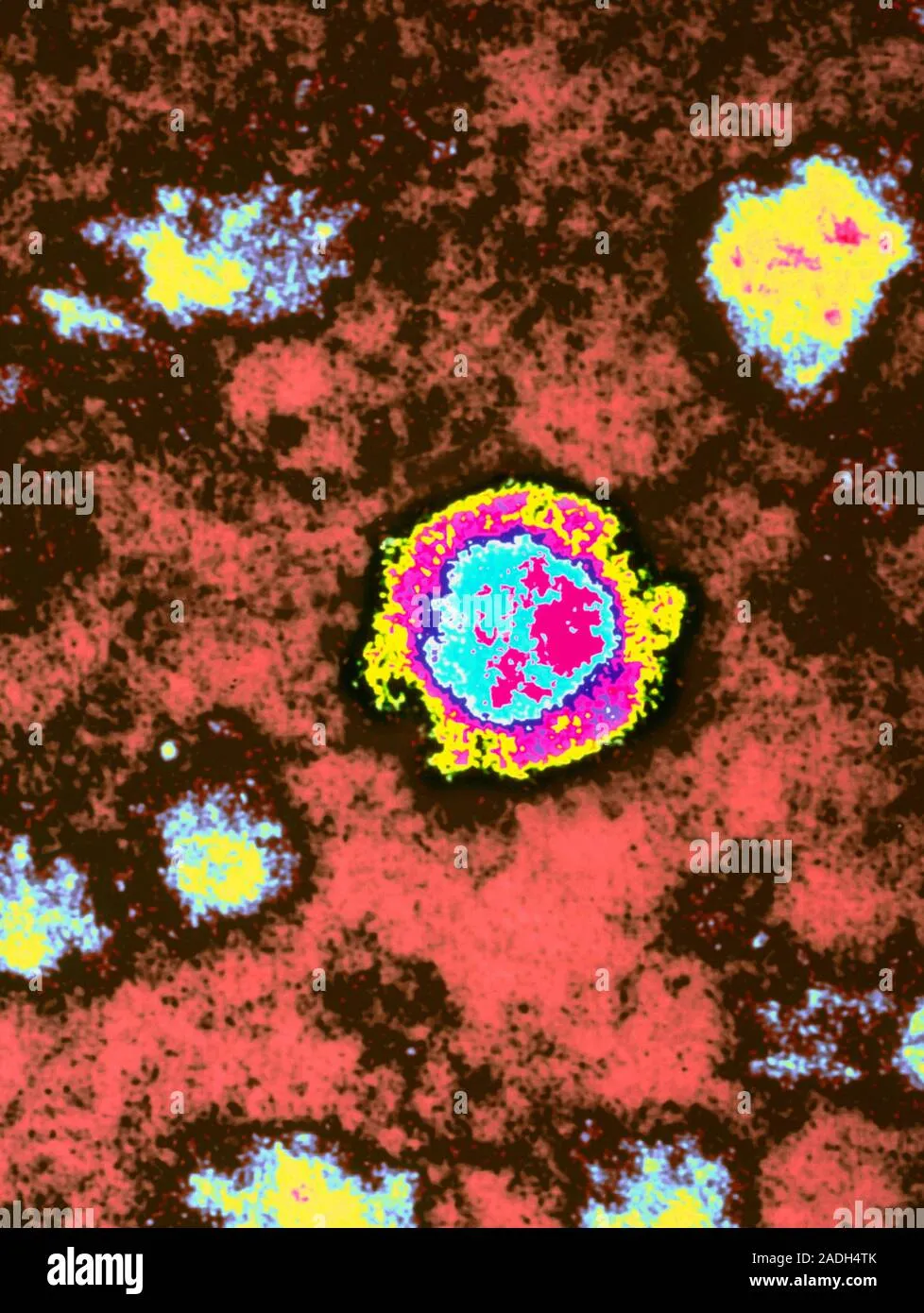 borna virus — DE news