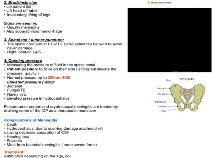 meningitis — DE news
