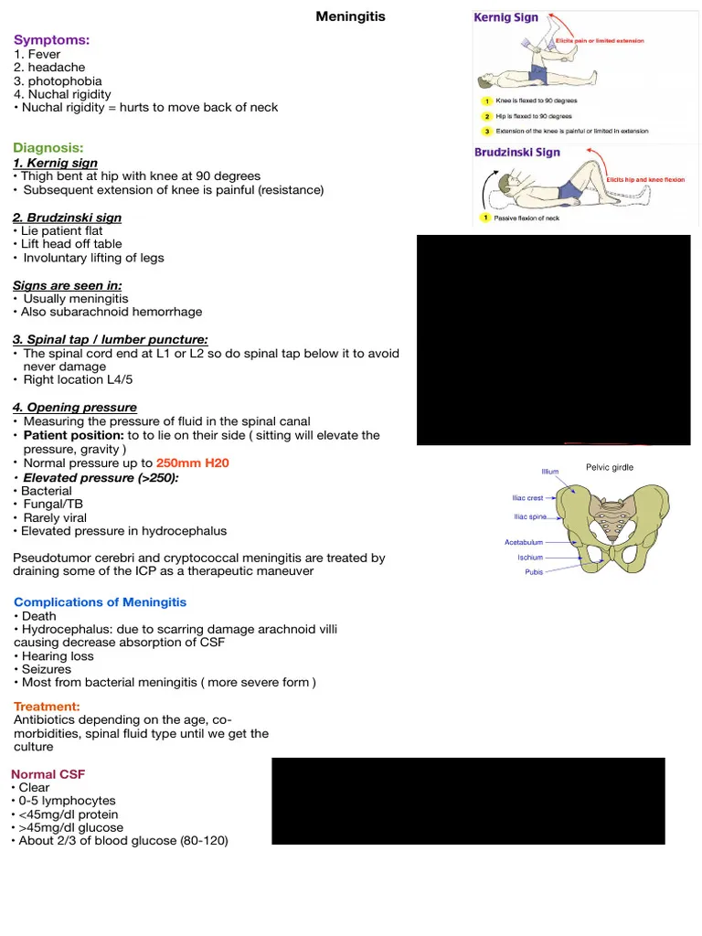 meningitis — DE news